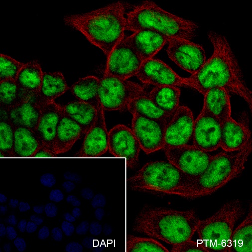 Anti-p53 Rabbit mAb