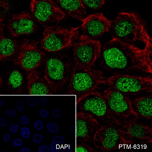 Anti-p53 Rabbit mAb