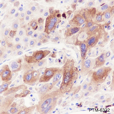 Anti-AFP Rabbit mAb