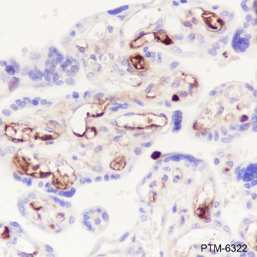 Anti-AFP Rabbit mAb