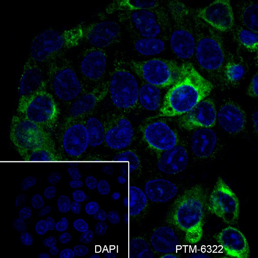 Anti-AFP Rabbit mAb