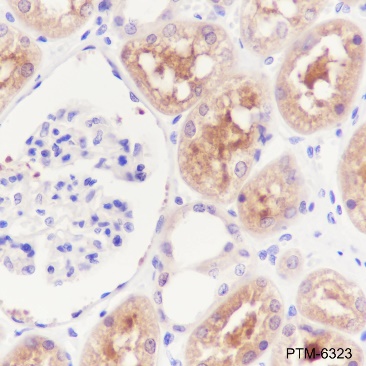 Anti-HDAC6 Rabbit mAb