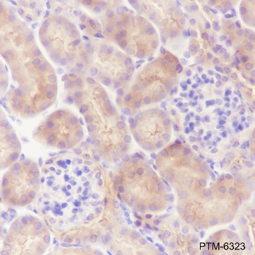 Anti-HDAC6 Rabbit mAb