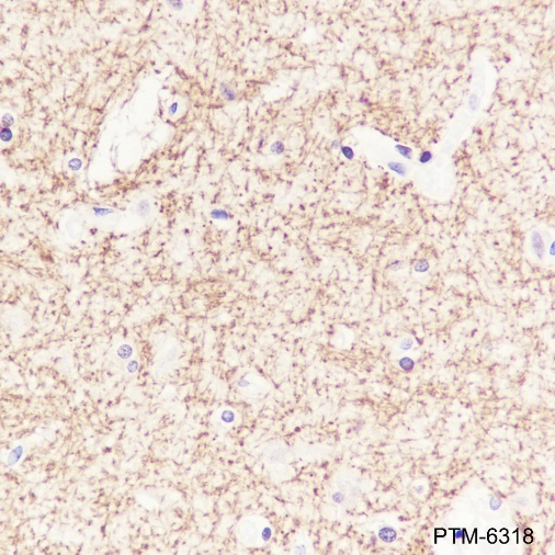 Anti-SIRT2 Rabbit mAb