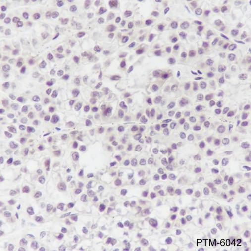 Anti-TBP Mouse mAb