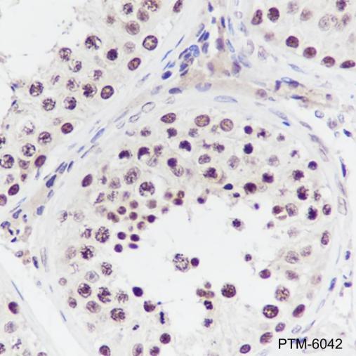 Anti-TBP Mouse mAb