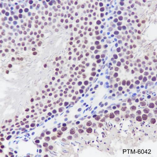 Anti-TBP Mouse mAb