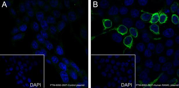 Anti-RANKL Mouse mAb