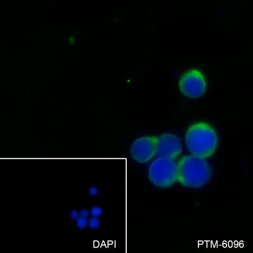 Anti-CD20 Mouse mAb