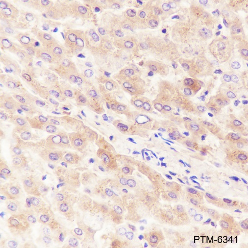 Anti-Hemopexin Rabbit mAb