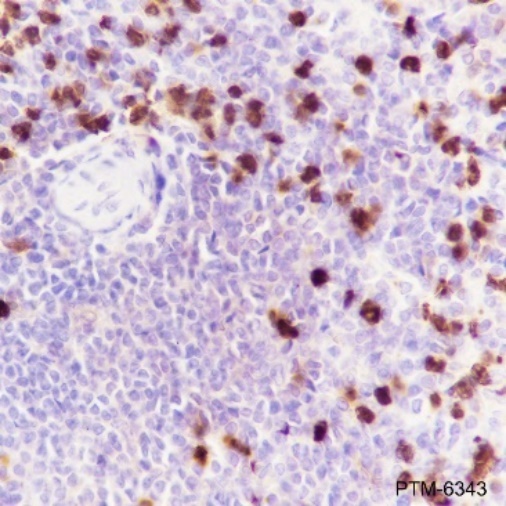 Anti-S100A9 Rabbit mAb