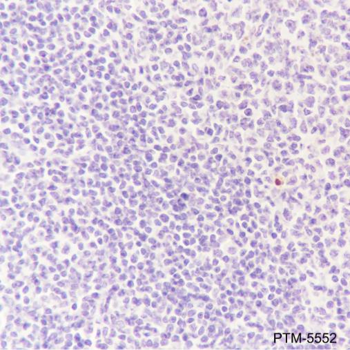 Anti-Prealbumin/Transthyretin Mouse mAb