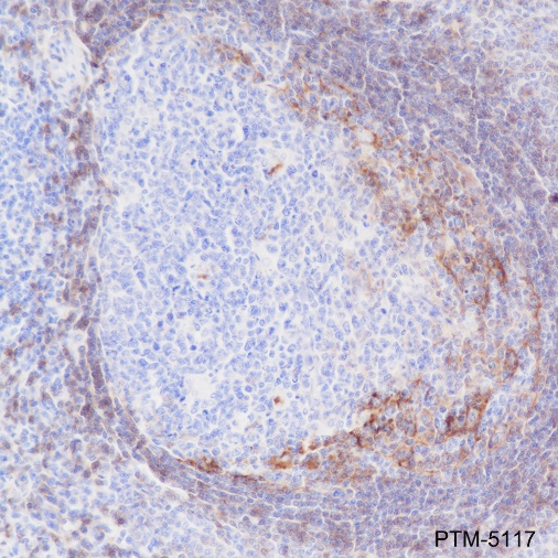 Anti-CD23 Rabbit mAb