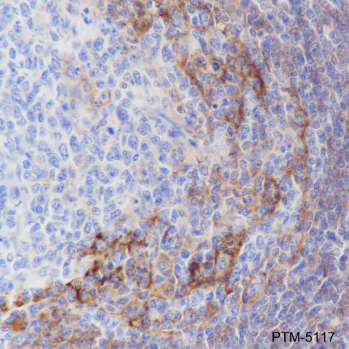 Anti-CD23 Rabbit mAb