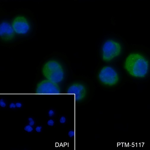 Anti-CD23 Rabbit mAb