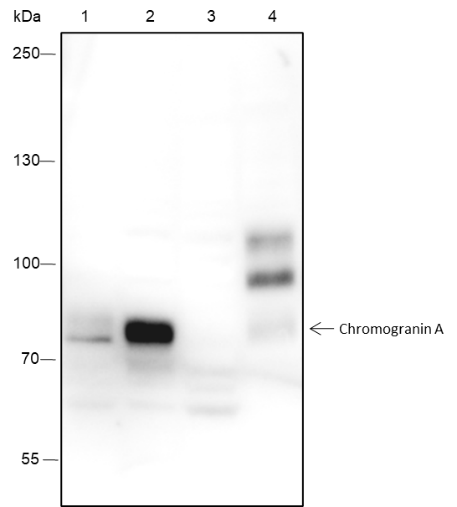 Anti-Chromogranin A Rabbit mAb