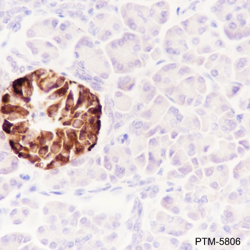 Anti-Chromogranin A Rabbit mAb