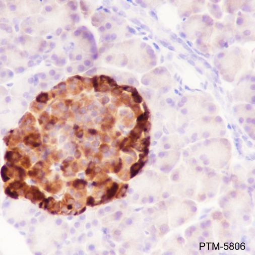 Anti-Chromogranin A Rabbit mAb