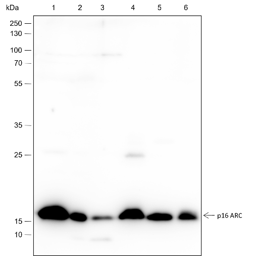 Anti-ARPC5 / p16 ARC Rabbit mAb