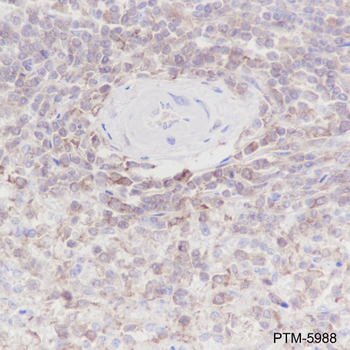Anti-ARPC5 / p16 ARC Rabbit mAb