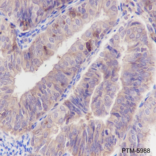 Anti-ARPC5 / p16 ARC Rabbit mAb