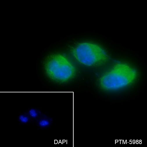 Anti-ARPC5 / p16 ARC Rabbit mAb