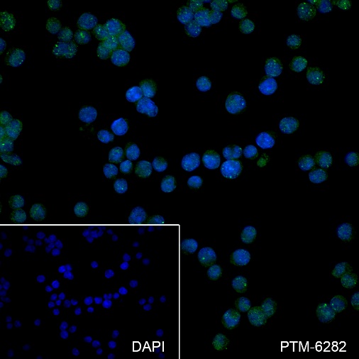 Anti-BOB-1/OBF-1 Rabbit mAb
