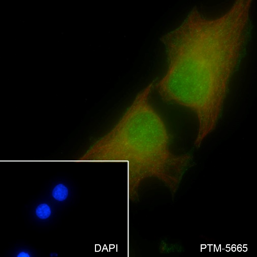 Anti-CDK6 Rabbit mAb