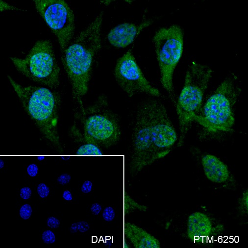 Anti-S100A1 Rabbit mAb