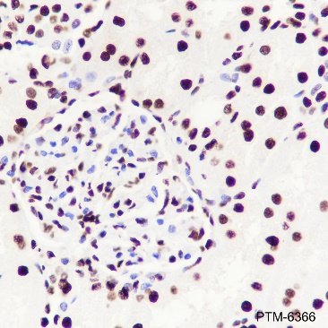 Anti-ILF3 Rabbit mAb