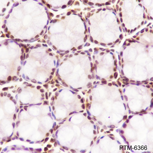Anti-ILF3 Rabbit mAb