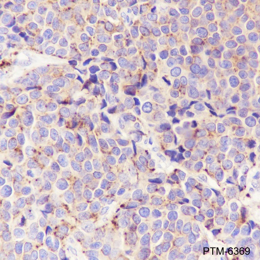 Anti-Cathepsin D Rabbit mAb