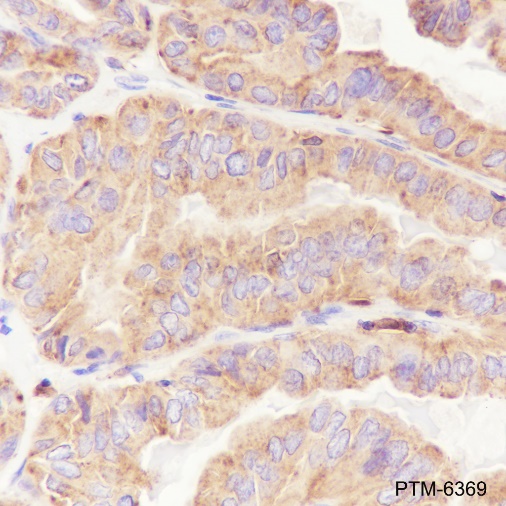 Anti-Cathepsin D Rabbit mAb