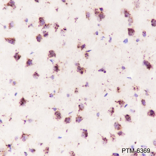 Anti-Cathepsin D Rabbit mAb