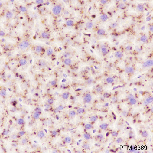 Anti-Cathepsin D Rabbit mAb