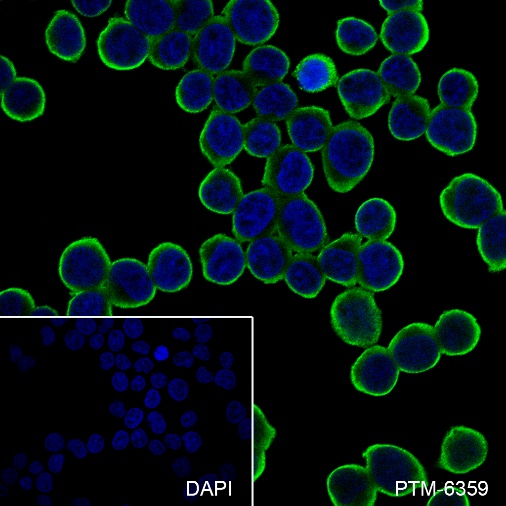 Anti-IL-7R/CD127 Rabbit mAb