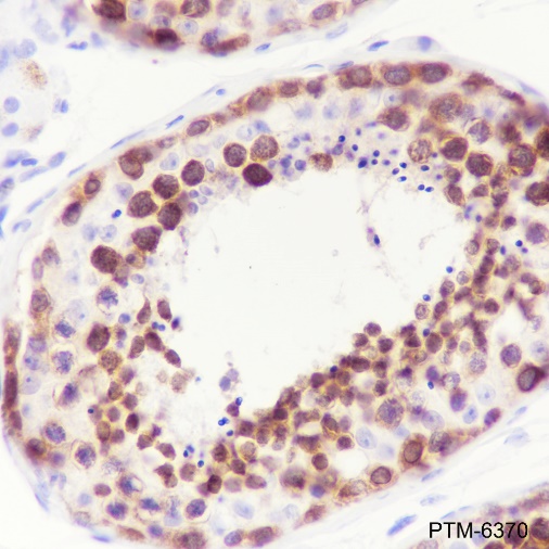 Anti-DDX4 Rabbit mAb