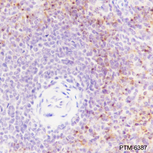 Anti-PF4 Rabbit mAb