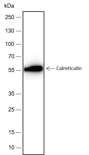 Anti-Calreticulin Rabbit mAb