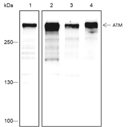 Anti-ATM Rabbit mAb