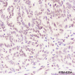Anti-ATM Rabbit mAb