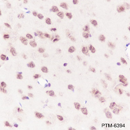 Anti-ATM Rabbit mAb