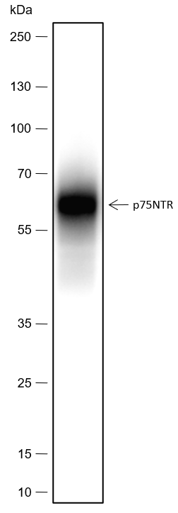 Anti-p75NTR Rabbit mAb