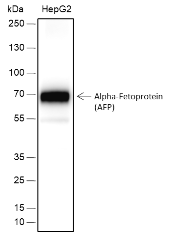 Anti-AFP Rabbit mAb