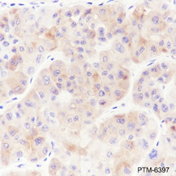 Anti-AFP Rabbit mAb