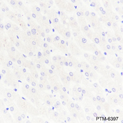 Anti-AFP Rabbit mAb