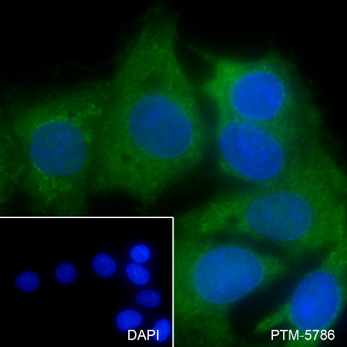 Anti-SMYD2 Mouse mAb
