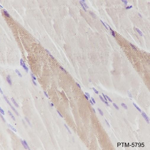 Anti-Myosin Light Chain 3 Mouse mAb