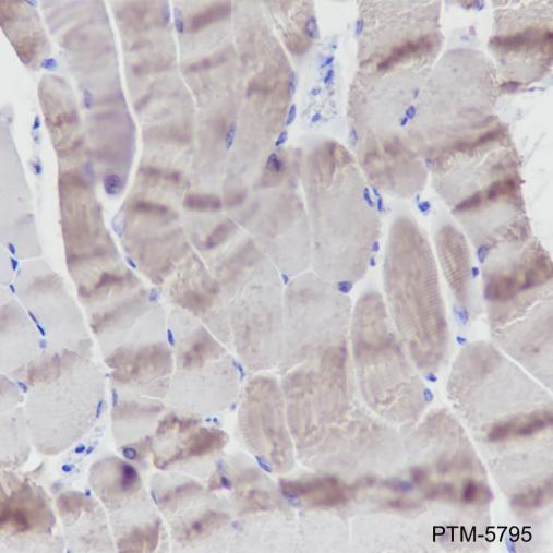 Anti-Myosin Light Chain 3 Mouse mAb