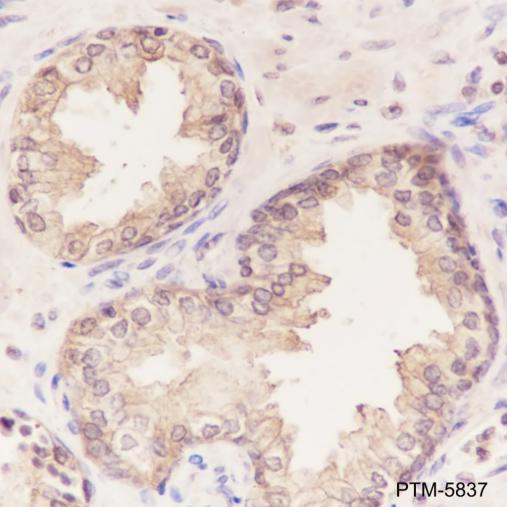 Anti-UGDH Mouse mAb